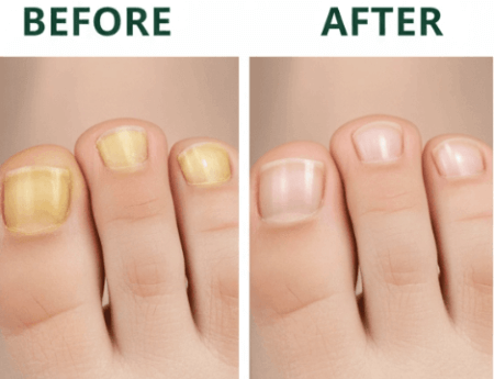 Nail-Refresh-benefit